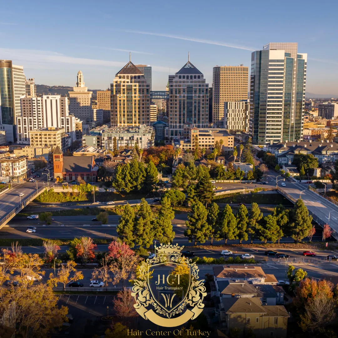 Hair Transplant Clinics in Oakland F