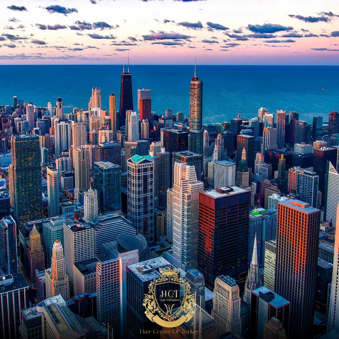 What Are the Best Hair Transplant Clinics in Oklahoma City F