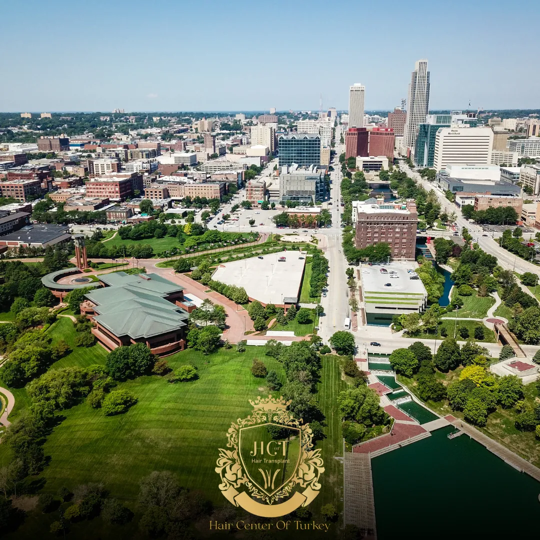 What Are the Best Hair Transplant Clinics in Omaha F