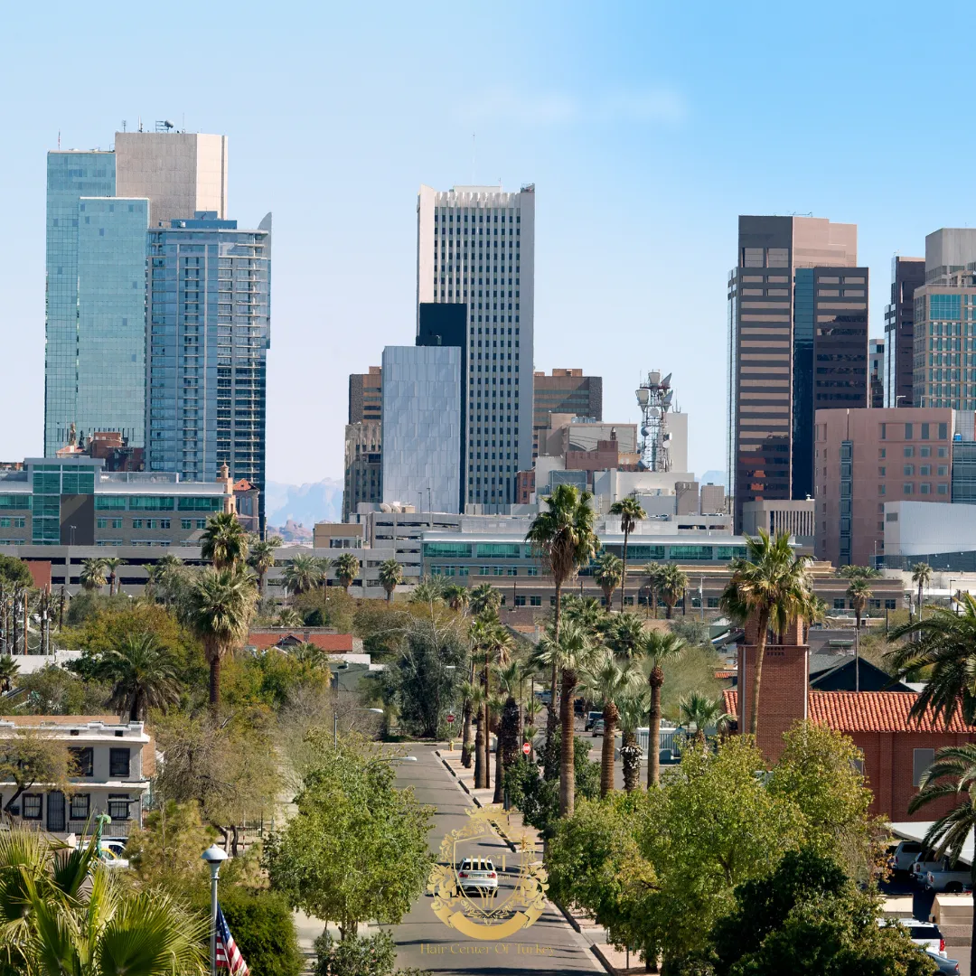 What Are the Best Hair Transplant Clinics in Phoenix F