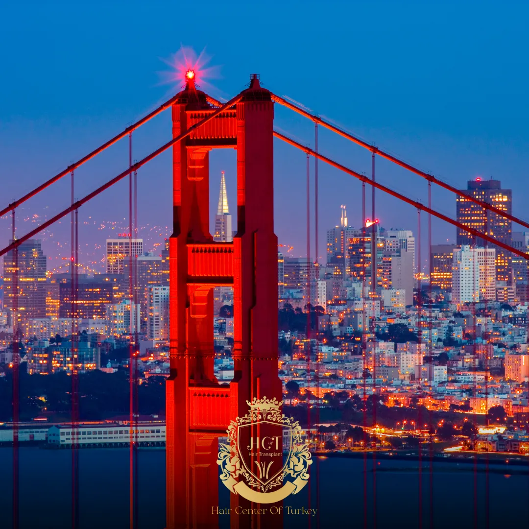 ¿Cuáles son las mejores clínicas de trasplante capilar en San Francisco? 1 What Are the Best Hair Transplant Clinics in San Francisco F