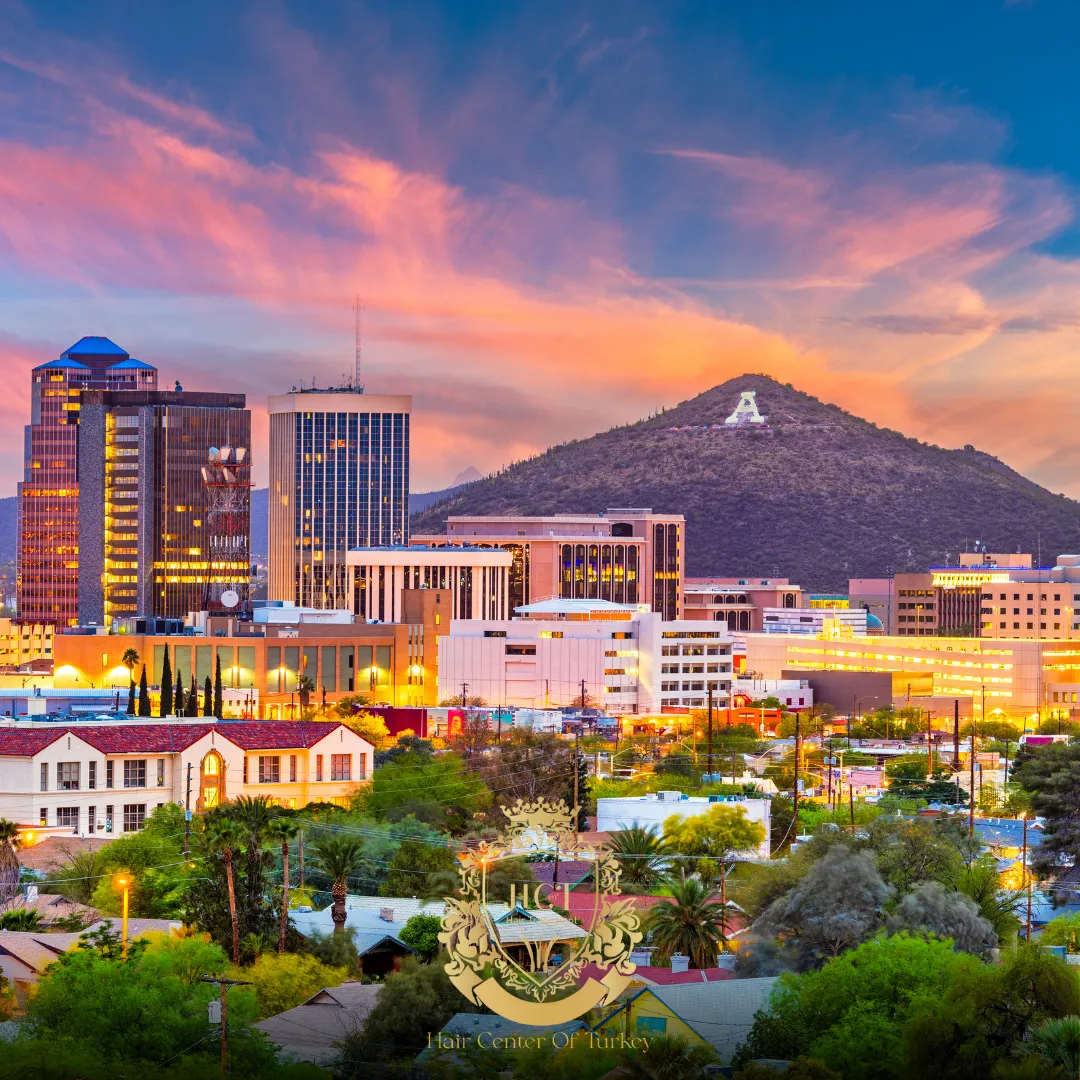 What Are the Best Hair Transplant Clinics in Tucson F