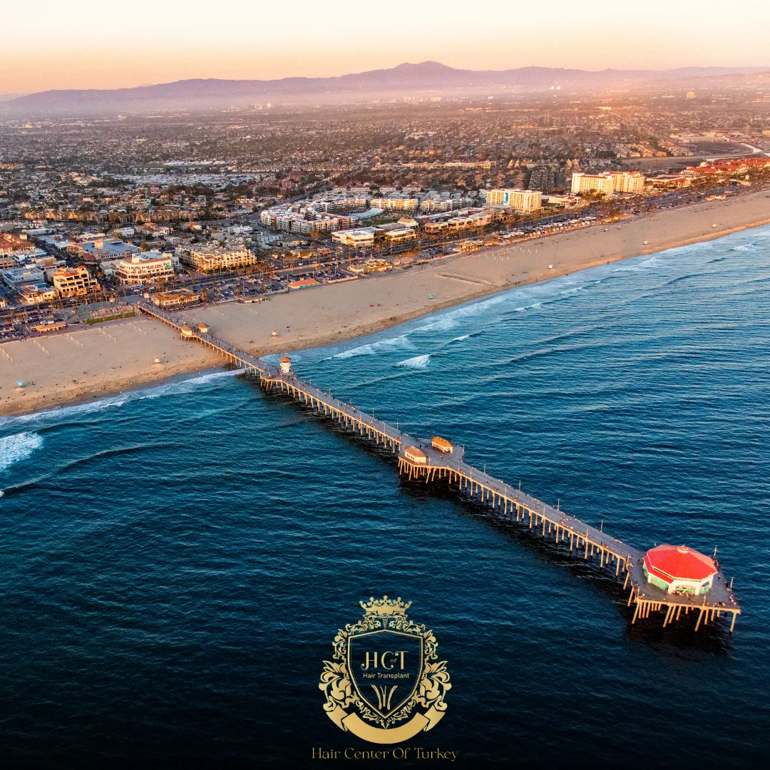 What Are the Best Hair Transplant Clinics in Virginia Beach F