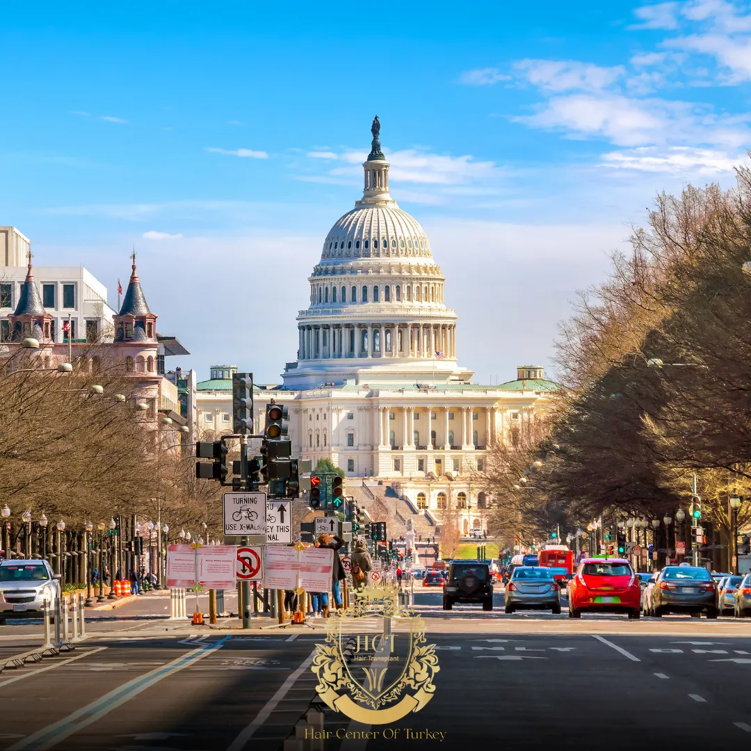 What Are the Best Hair Transplant Clinics in Washington DC f