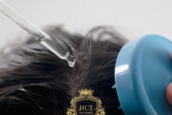 Quais são os remédios naturais para reduzir a queda de cabelo?