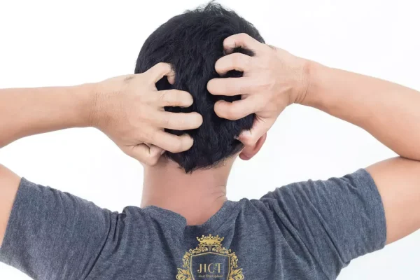 Soothing an Itchy Scalp: What Works?