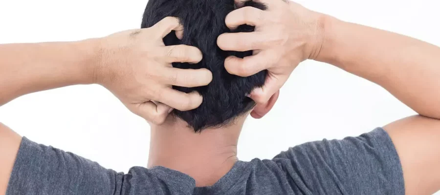 O que pode acalmar o seu couro cabeludo (1)