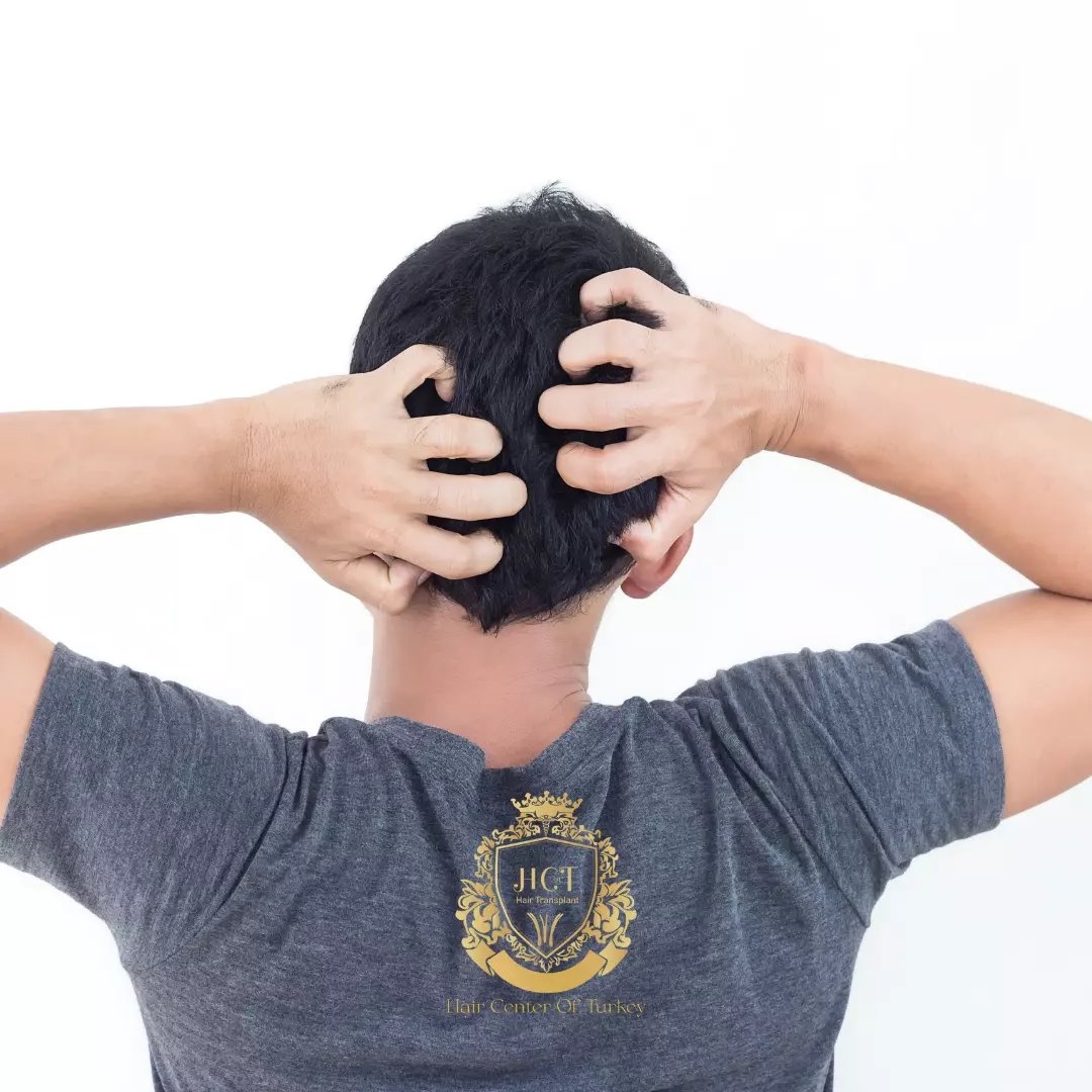 O que pode acalmar o seu couro cabeludo (1)