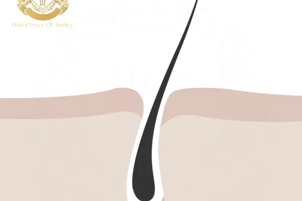 Telogen Phase: What Happens During The Resting Stage Of Hair Growth