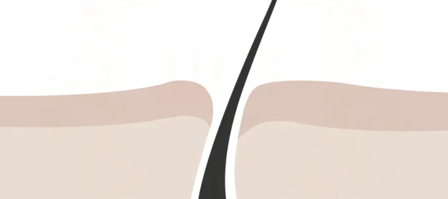 O que acontece durante a fase telógena do ciclo de crescimento capilar F