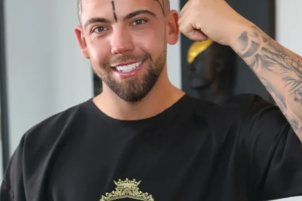 Optimales Alter für eine Haartransplantation