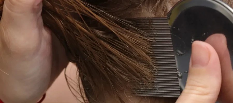 What Causes Head Lice? | How Does Hair Loss Affect? 1 What Causes Head Lice? | How Does Hair Loss Affect?