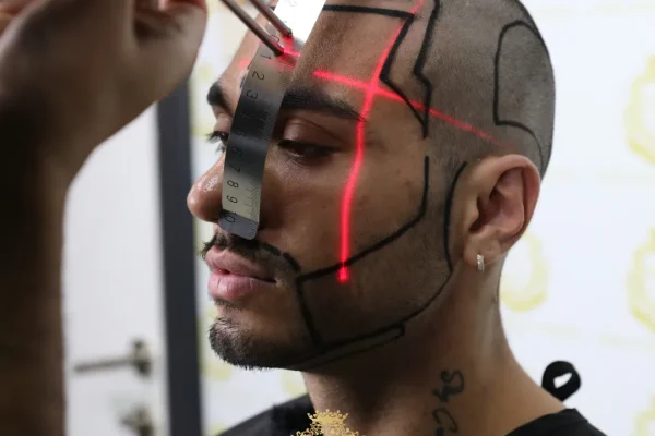 Wann ist die beste Jahreszeit für eine Barttransplantation?