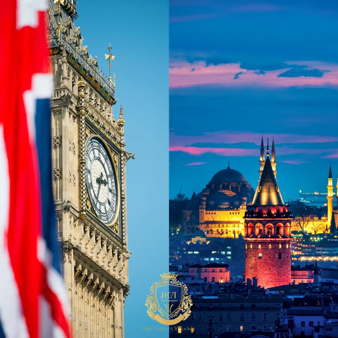 Dónde hacerse un trasplante capilar: Guía comparativa entre Reino Unido y Turquía