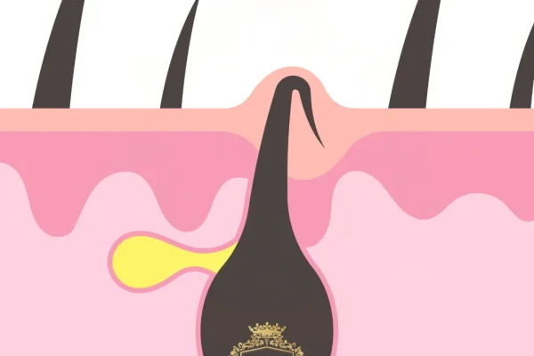 Home Remedies for Ingrown Hair: What Works and What to Skip