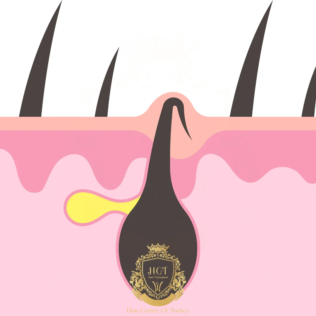 ¿Qué remedios caseros funcionan mejor para el vello encarnado?