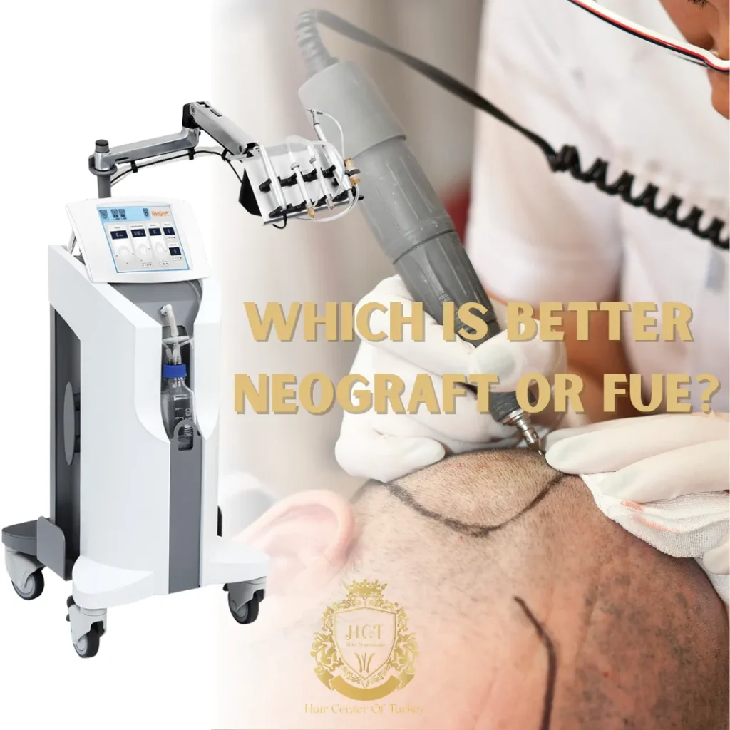 Qual è meglio NeoGraft o FUE F