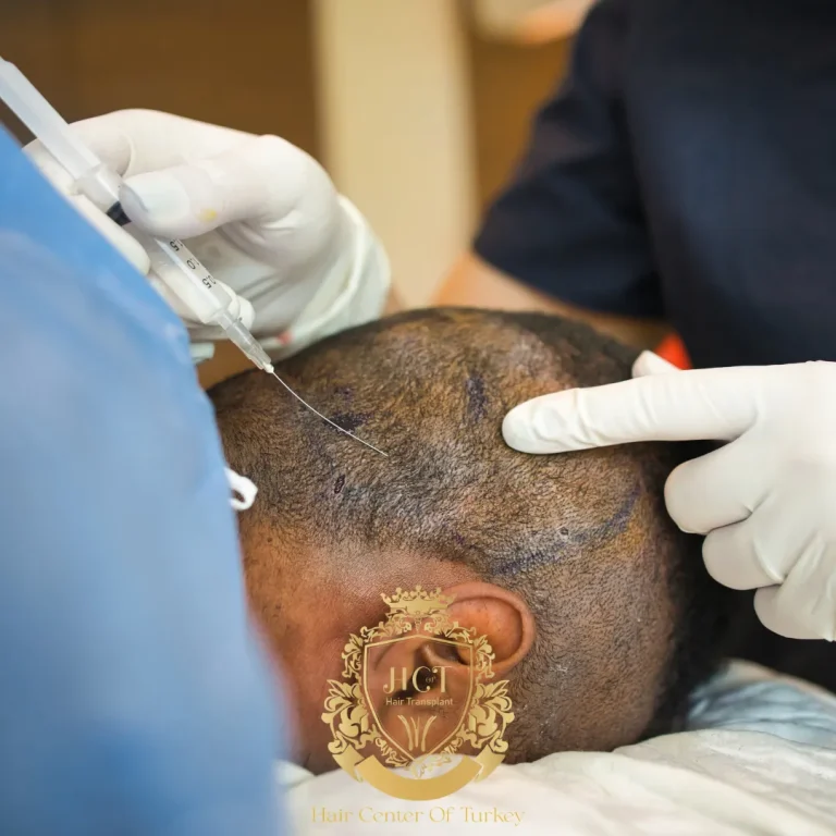 Which Type of Anesthesia Is Best for Hair Transplant Surgery?