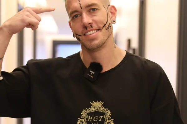 Warum ist die Türkei so beliebt für Haartransplantationen?