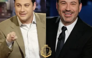 Jimmy Kimmel Haartransplantatie 8 Jimmy Kimmel Haartransplantatie