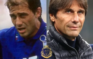 Antonio Conte Haartransplantatie 4 Antonio Conte Haartransplantatie