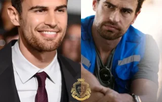 Theo James Haartransplantatie 6 Theo James Haartransplantatie