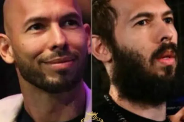 Andrew Tate Haartransplantation: Was Ist Bestätigt Und Was Ist Gerücht + Grundlagen Der Haartransplantation