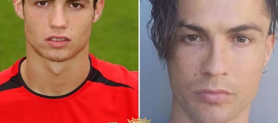 Hat Cristiano Ronaldo Eine Haartransplantation Gehabt? Fakten, Gerüchte Und Was Wir Tatsächlich Wissen