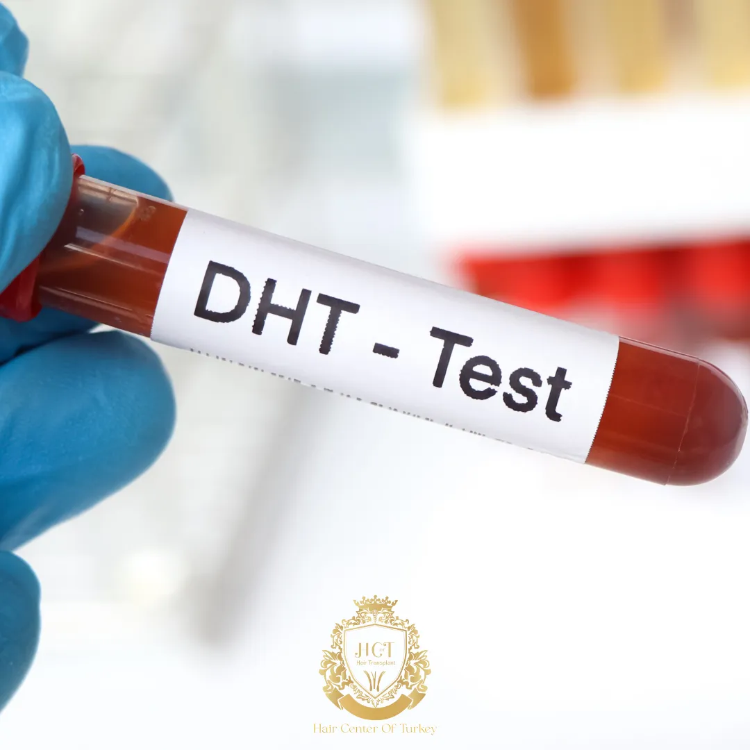 DHT Blockers: What You Should Know About Natural DHT Blockers 1 dht blockers