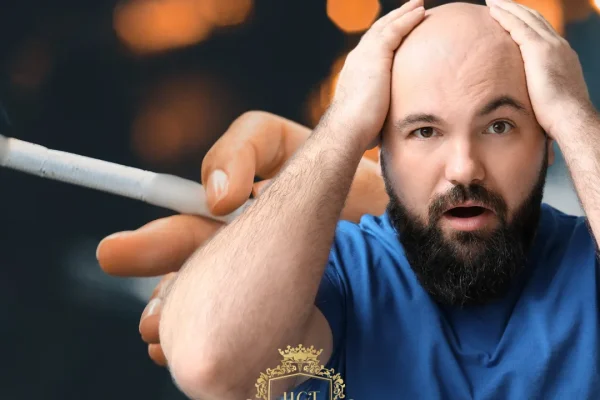 Does Smoking Affect Hair Loss? Causes, Evidence, and What Helps