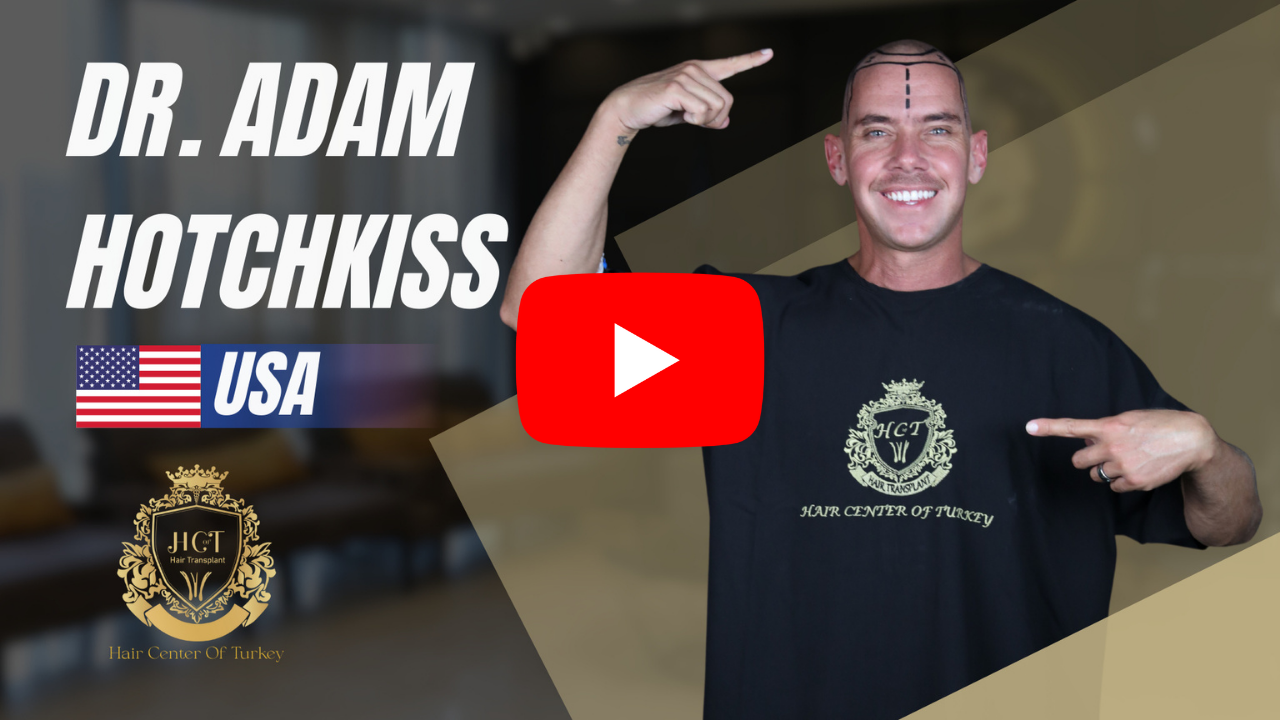 mpcopy 28 dr adam hotchkiss hair transplant journey th