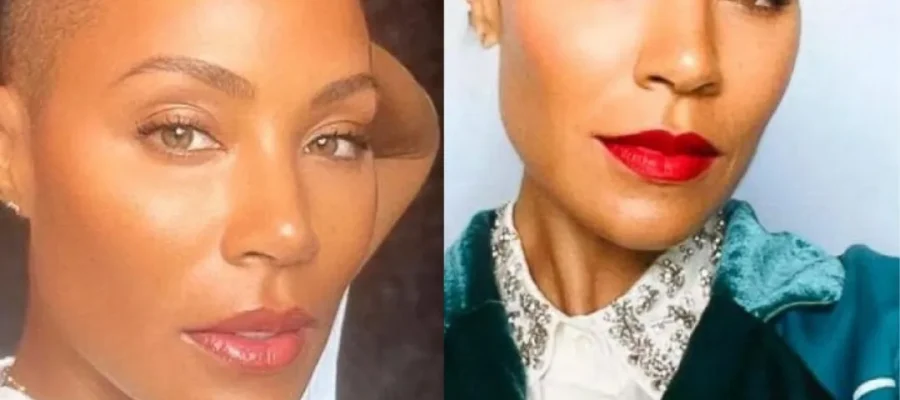 female celebrities hair loss