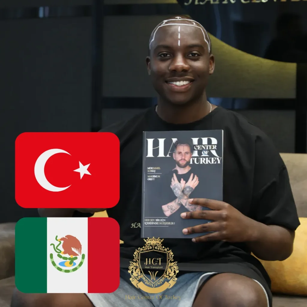 Mexique ou Turquie pour la greffe de cheveux