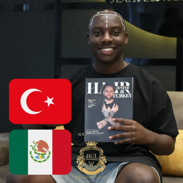 Is Mexico or Turkey Better for Hair Transplant?