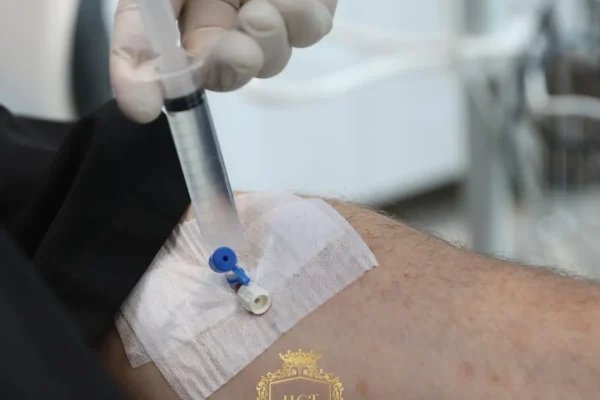 Haartransplantation mit Sedierung