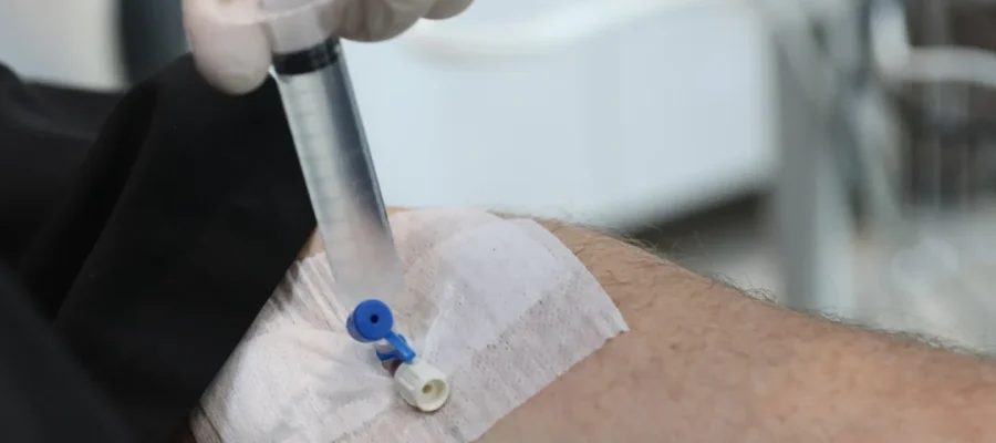 Greffe de cheveux sous sédation