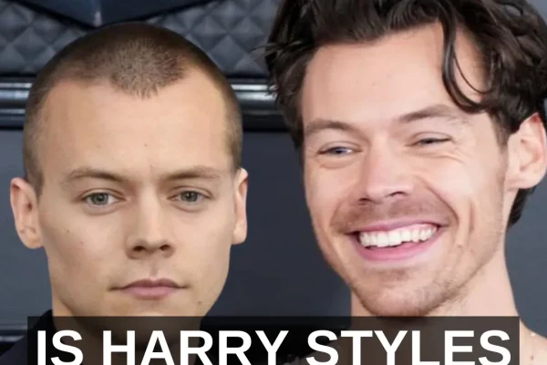 Ist Harry Styles kahlköpfig?