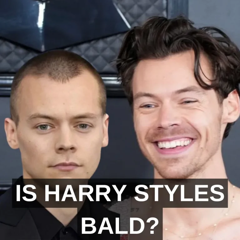 Harry Styles è calvo