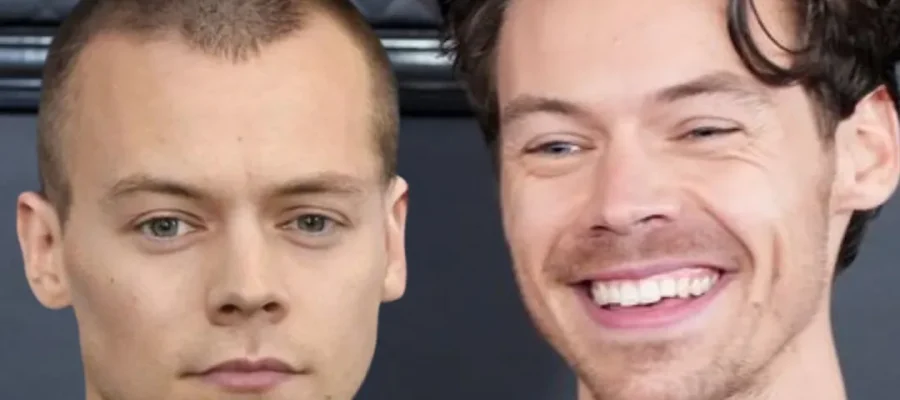 harry styles is bald