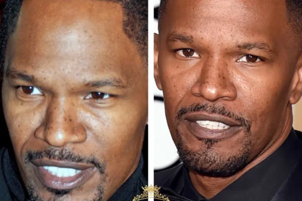 Jamie Foxx Haartransplantation: Hat Er Eine Machen Lassen?