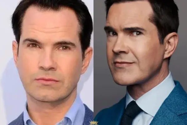 Jimmy Carr Haartransplantation: Welche Technik Wurde Verwendet?