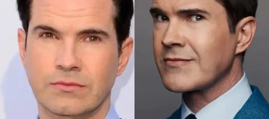 Jimmy Carr Haartransplantation: Welche Technik Wurde Verwendet?