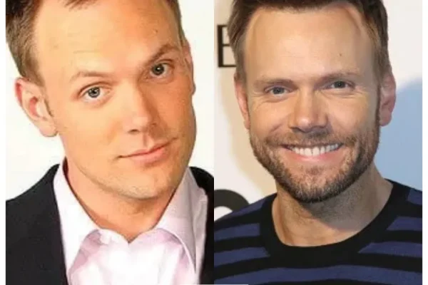 Joel Mchale Haartransplantation: Was Er Gesagt Hat, Ergebnisse, Kosten Und Transplantaten