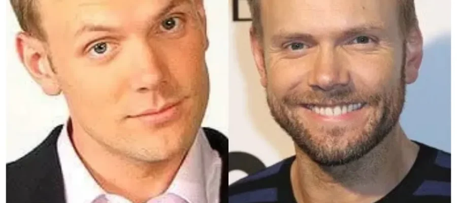joel mchale hair transplant