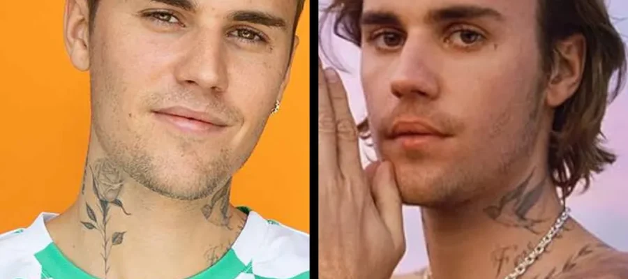 justin bieber hair transplant