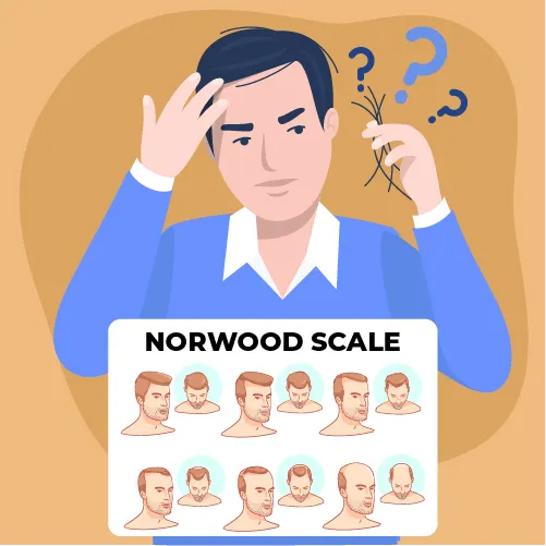 male pattern baldness and norwood scale