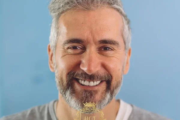 Marie Antoinette Syndrome (Canities Subita): Causes, Symptoms, And What’s Really Happening