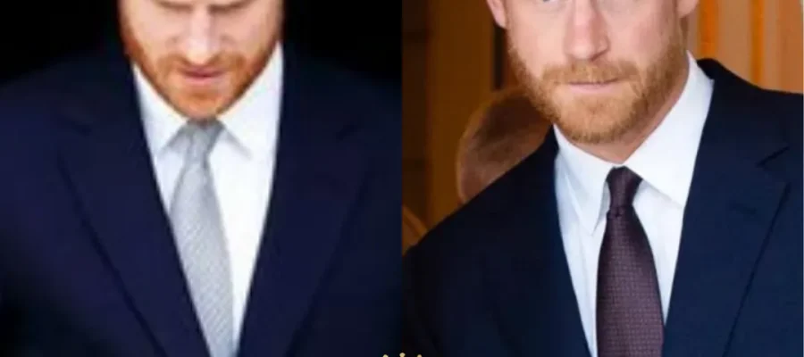 prince harry hair transplant
