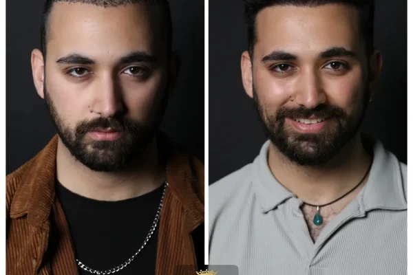 Recovery Process After Hair Transplant