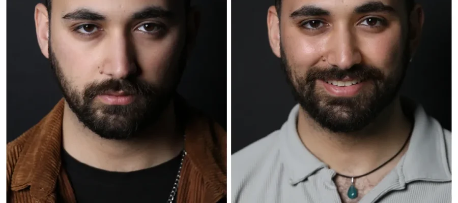 Processus de Récupération Après une Greffe Capillaire